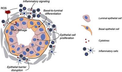 Applications of Vertebrate Models in Studying Prostatitis and Inflammation-Associated Prostatic Diseases